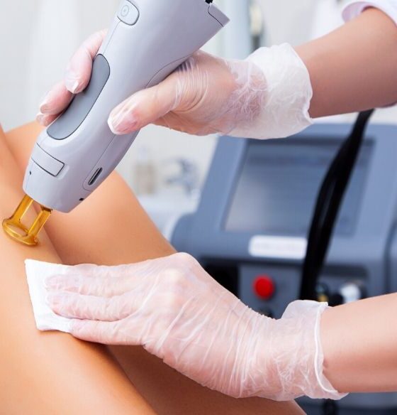 Common Methods of Cosmetic Vein Treatment