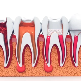 How to Choose the Right Personal Trainer for Your Fitness Journey