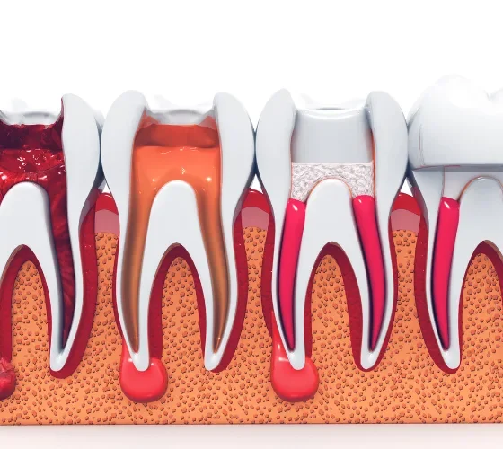 Emergency Room Procedures for Treating Allergic Reactions