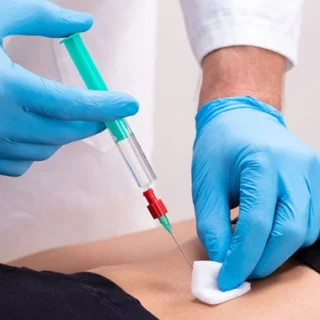 Common Methods of Cosmetic Vein Treatment