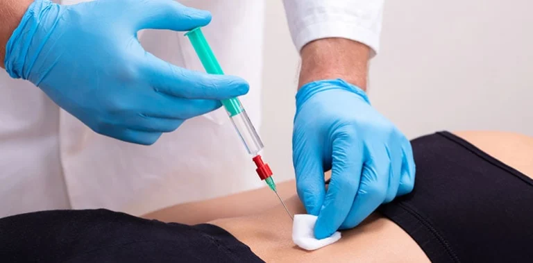 FAQs About Kyphoplasty
