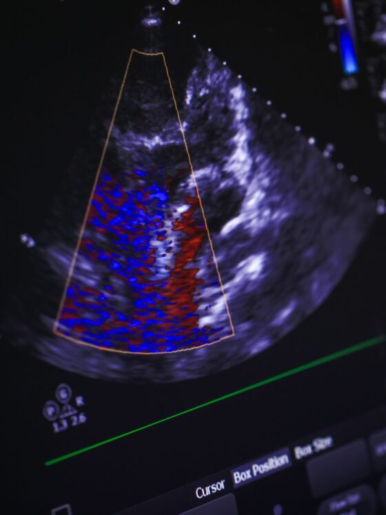How Cardiologists Use Echocardiograms for Heart Health Diagnosis