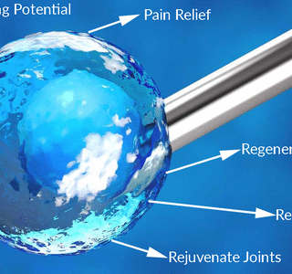 How Cardiologists Use Echocardiograms for Heart Health Diagnosis