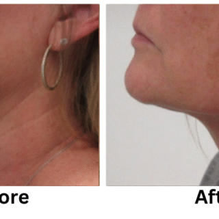 The Impact of Lifestyle Changes on Preventive Health Outcomes