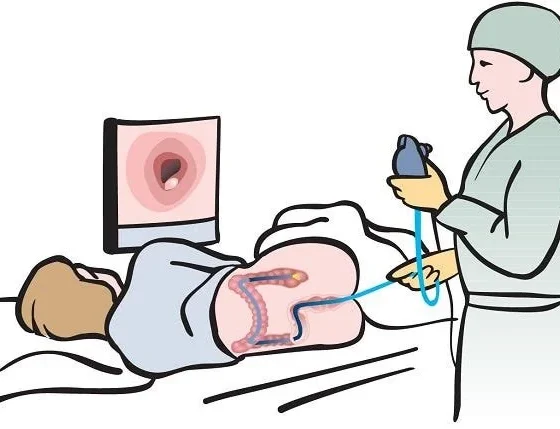 Navigating Your First Colonoscopy