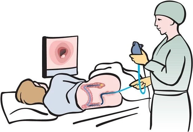 Navigating Your First Colonoscopy