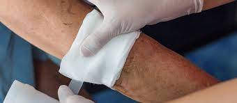 Special Considerations For Wound Care in Diabetic Patients