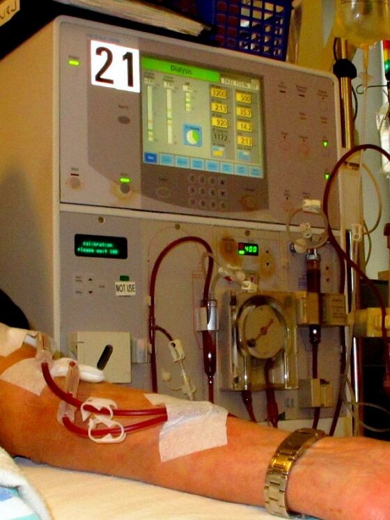 The Role of Dialysis Access in Kidney Health