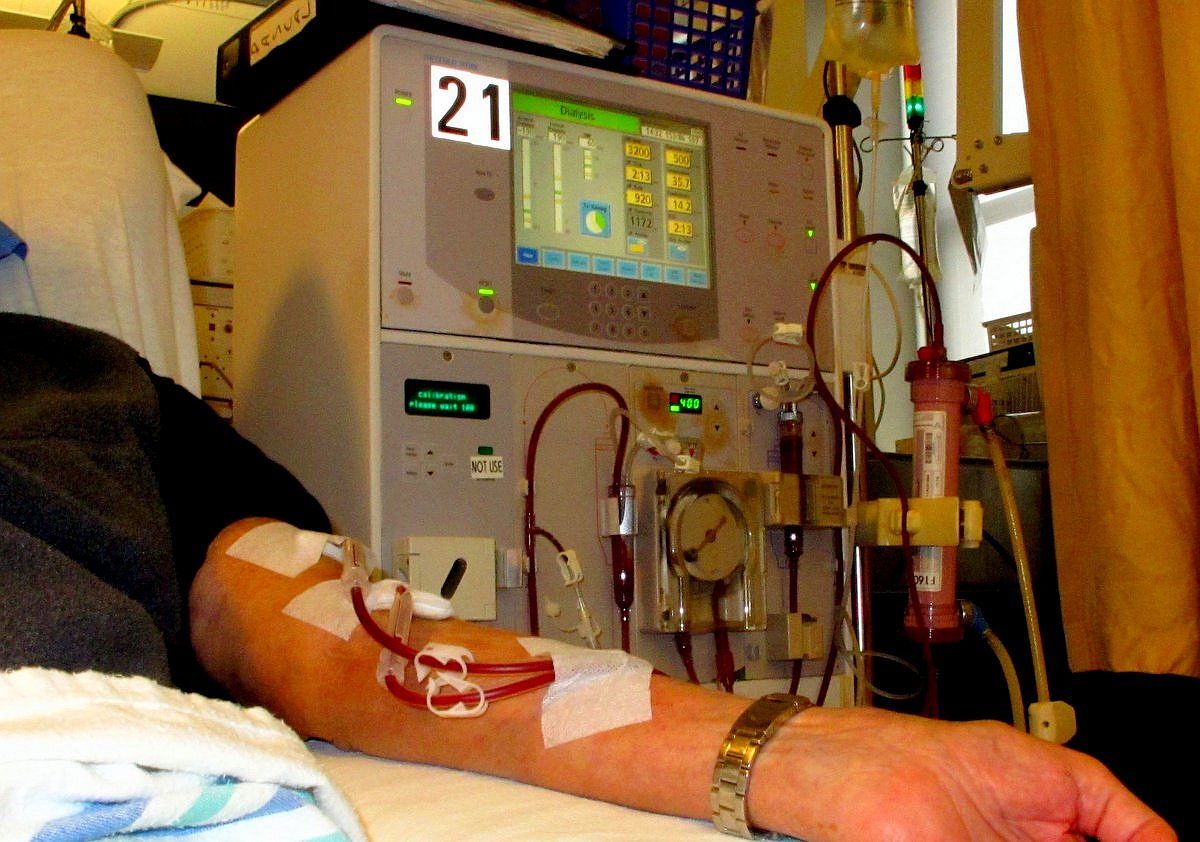 The Role of Dialysis Access in Kidney Health