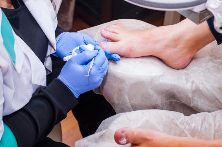 The Role of a Podiatrist in Managing Ingrown Toenails