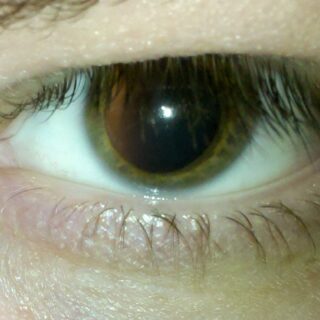 What To Do if Your Ingrown Toenail Is Causing You Pain