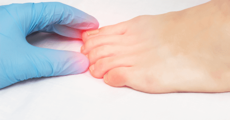 What To Do if Your Ingrown Toenail Is Causing You Pain
