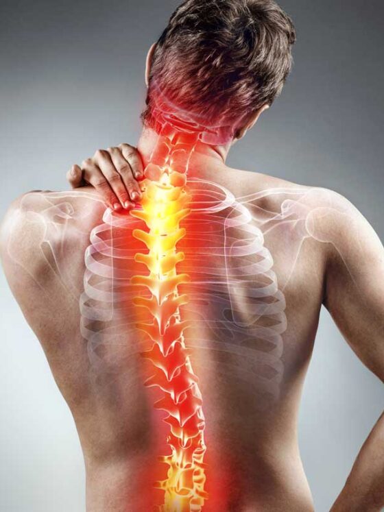 What To Know About Spine Surgery for Scoliosis