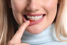 When To See a Periodontist