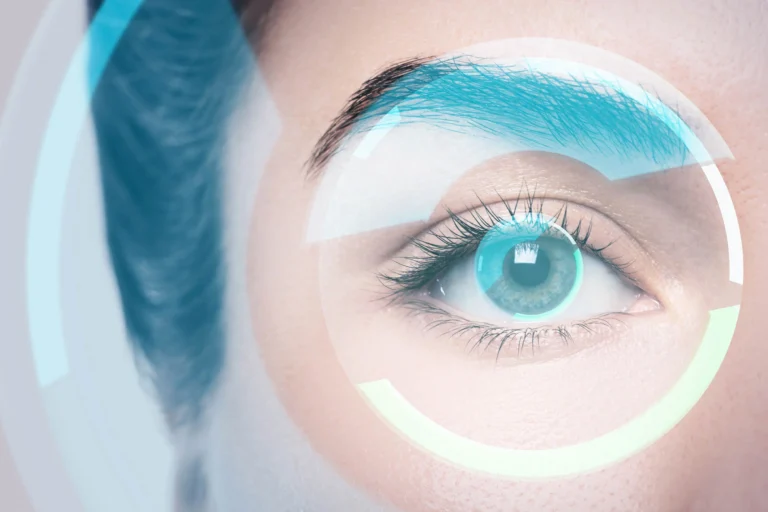 Exploring the Benefits of LASIK Surgery