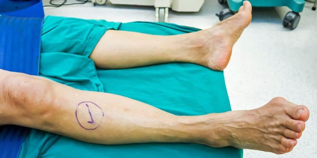 Podiatrist Advice on Footwear for Bunions