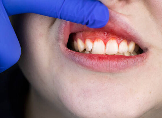 The Link Between Periodontal Disease and Systemic Conditions