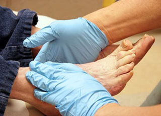 Understanding When to See a Vein Specialist for Varicose Veins