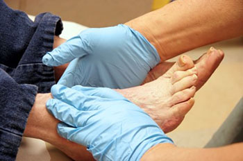The Role of a Podiatrist in Managing Diabetic Foot Health