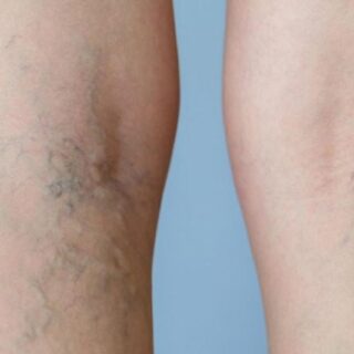 The Role of a Podiatrist in Managing Diabetic Foot Health